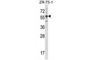 KRT3 Antibody (Center) western blot analysis in ZR-75-1 cell line lysates (35µg/lane). (Keratin 3 antibody  (Middle Region))