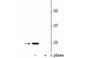 Western blot of rat hippocampal lysate showing specific immunolabeling of the ~25 kDa SNAP25 phosphorylated at Ser187 in the first lane (-). (SNAP25 antibody  (pSer187))