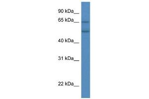 WB Suggested Anti-CYP2S1 Antibody Titration:  0.