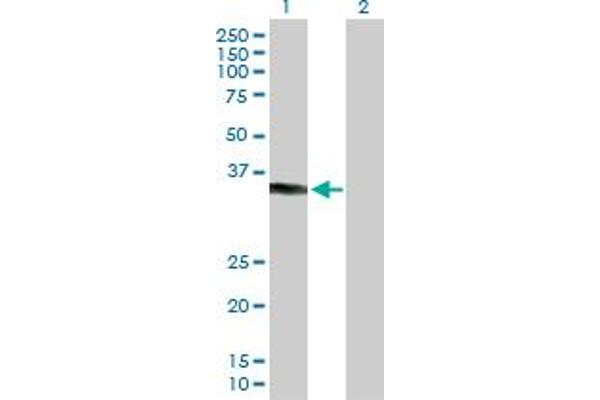 KCTD7 anticorps  (AA 1-289)