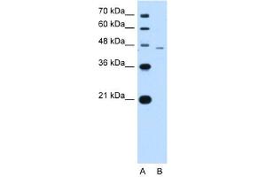 WB Suggested Anti-SMAD7 Antibody Titration:  1. (SMAD7 antibody  (N-Term))