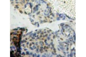IHC-P analysis of Ovary tissue, with DAB staining.