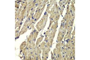 Immunohistochemistry of paraffin-embedded mouse heart using FXN antibody. (Frataxin antibody  (AA 42-210))