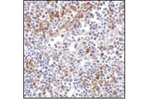 Immunohistochemistry of MDA5 in human lymph node tissue with this product at 5 μg/ml. (IFIH1 antibody  (C-Term))
