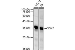 Western blot analysis of extracts of various cell lines, using SOX2 antibody (ABIN6130648, ABIN6148295, ABIN6148297 and ABIN6215241) at 1:500 dilution. (SOX2 antibody  (AA 1-140))
