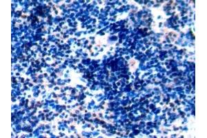 Immunohistochemistry (IHC) image for anti-Protein tyrosine Phosphatase, Receptor Type, C (PTPRC) (AA 357-547) antibody (ABIN7445726)