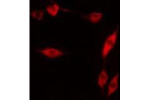Immunofluorescence (fixed cells) (IF/ICC) image for anti-Apurinic/Apyrimidinic Endonuclease 1 (APEX1) (N-Term) antibody (ABIN6259977)
