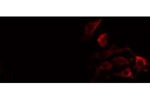 ABIN6274373 staining HT29 cells by IF/ICC.