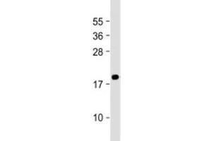 Western blot testing of human PC-3 cell lysate with MEAF6 antibody at 1:2000. (MEAF6 antibody  (AA 120-154))