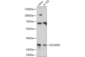 Western blot analysis of extracts of various cell lines, using SC antibody (ABIN7270188) at 1:1000 dilution.