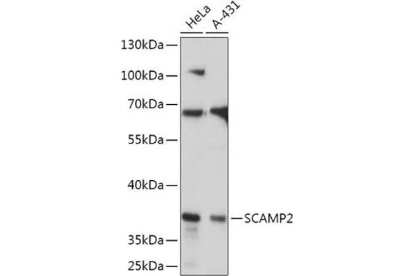 SCAMP2 antibody  (AA 1-152)