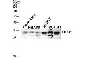 Western Blot (WB) analysis of Mouse Brain HeLa KB SH-SY5Y 293T 3T3 lysis using CTDSP1 antibody. (CTDSP1 antibody  (N-Term))
