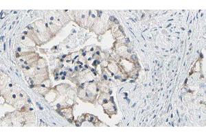 ABIN6278120 at 1/100 staining Human prostate tissue by IHC-P. (TRIM29 antibody  (Internal Region))