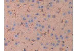 IHC-P analysis of Mouse Cerebrum Tissue, with DAB staining. (IL11RA antibody  (AA 59-217))
