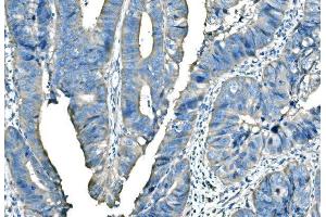 IHC analysis of B Raf/BRAF using anti-B Raf/BRAF antibody (ABIN3043761).