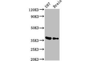 Western Blot Positive WB detected in U87 whole cell lysate 77ouse brain tissue All lanes GAPDH antibody at 0. (Recombinant GAPDH antibody)