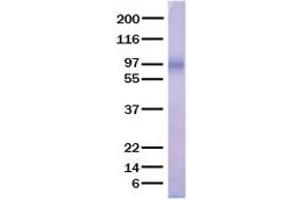 Western Blotting (WB) image for Angiopoietin-Like 3 (ANGPTL3) (Active) protein (His tag) (ABIN2714690)