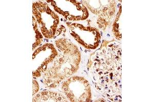 Immunohistochemical analysis of paraffin-embedded H. (SSNA1 antibody  (N-Term))