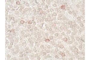 Immunohistochemistry analysis of human tonsil tissue (60x) using LAG-3 (human) recombinant mAb (L4-PL33), at a dilution of 1:50