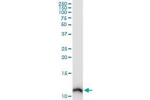 S100A10 monoclonal antibody (M09), clone 3E10. (S100A10 antibody  (AA 1-97))