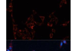 Immunofluorescence analysis of NIH/3T3 cells using GPC4 Polyclonal Antibody at dilution of 1:100. (GPC4 antibody)