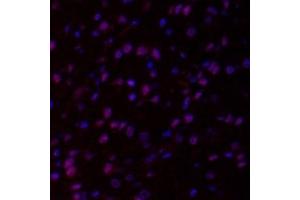 Immunofluorescent analysis of paraformaldehyde-fixed rat brain using,HECTD1 (ABIN7074186) at dilution of 1: 2000 (HECTD1 antibody)
