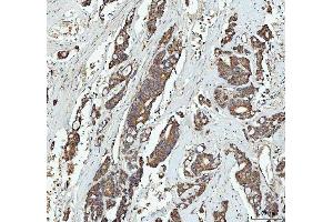 IHC analysis of GRB10 using anti-GRB10 antibody (ABIN7599160).