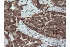 Image no. 8 for anti-Carboxypeptidase A2 (Pancreatic) (CPA2) antibody (ABIN1497598) (Carboxypeptidase A2 antibody)