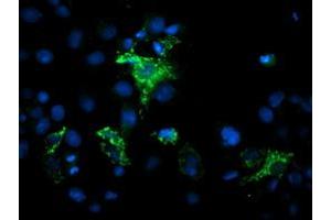 MIPEP antibody  (AA 174-516)