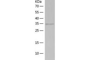 Western Blotting (WB) image for Adaptor-Related Protein Complex 1 Associated Regulatory Protein (AP1AR) (AA 1-302) protein (His tag) (ABIN7121697) (AP1AR Protein (AA 1-302) (His tag))