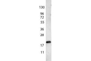 anti-Human VEGF-165 antibody shows detection of a band ~22 kDa in size corresponding to recombinant human VEGF-165. (VEGF 165 antibody)