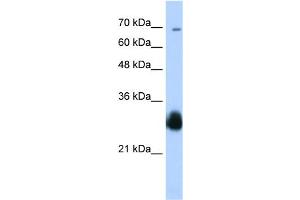 WB Suggested Anti-RNF138 Antibody Titration:  0. (RNF138 antibody  (C-Term))
