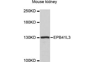Western blot analysis of extracts of mouse kidney, using EPB41L3 antibody (ABIN6290317) at 1:3000 dilution.