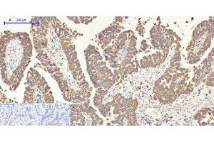 anti-Cytochrome C Oxidase Subunit II (COX2) antibody