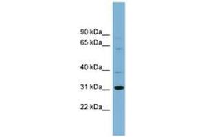Image no. 1 for anti-Chromosome 22 Open Reading Frame 31 (C22orf31) (AA 71-120) antibody (ABIN6742136) (C22orf31 antibody  (AA 71-120))