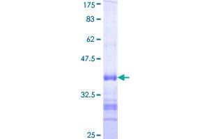 Retinoic Acid Receptor gamma Protein (AA 43-132) (GST tag)