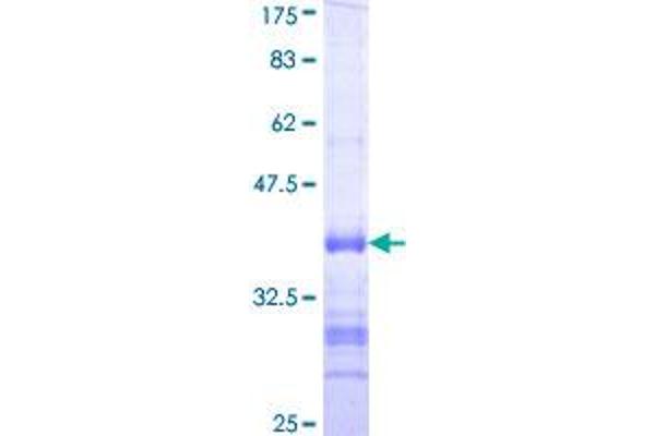 Retinoic Acid Receptor gamma Protein (AA 43-132) (GST tag)