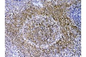 IHC testing of FFPE rat spleen tissue with PAX5 antibody at 1ug/ml. (PAX5 antibody)