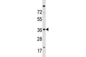 ISL2 antibody western blot analysis in A2058 lysate (ISL2 antibody  (AA 1-30))