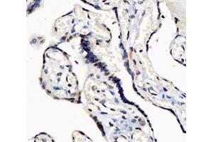 Immunohistochemistry analysis of paraffin-embedded human placenta using,GINS2 (ABIN7074041) at dilution of 1: 3000 (GINS2 antibody)