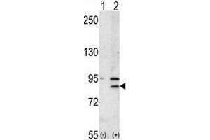 Western blot analysis of BRD2 (arrow) using rabbit polyclonal BRD2 Antibody (Center) (ABIN392609 and ABIN2842131). (BRD2 antibody  (AA 170-200))