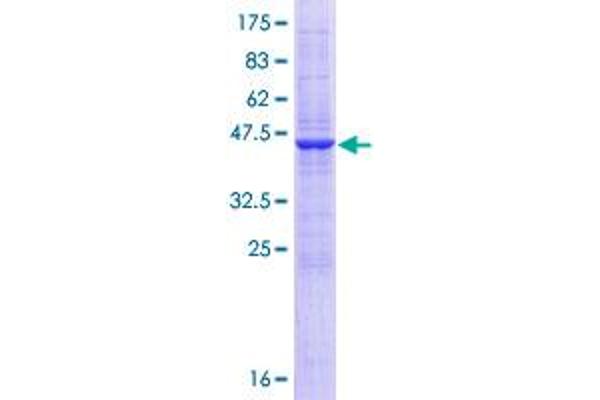 SSR2 Protein (AA 1-186) (GST tag)