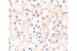 Used in DAB staining on fromalin fixed paraffin- embedded Kidney tissue (CD101 antibody  (AA 666-937))