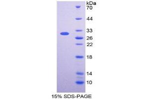 SDS-PAGE (SDS) image for V-Fos FBJ Murine Osteosarcoma Viral Oncogene Homolog (FOS) (AA 55-298) protein (His tag) (ABIN1980917) (FOS Protein (AA 55-298) (His tag))