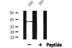 Western blot analysis of extracts from 293, using SLC25A6 Antibody. (SLC25A6 antibody  (Internal Region))