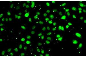 Immunofluorescence analysis of HeLa cells using NUDT2 Polyclonal Antibody (NUDT2 antibody)