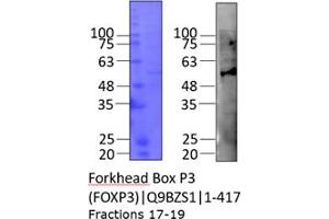 Western Blotting (WB) image for Forkhead Box P3 (FOXP3) (AA 1-417) protein (His tag) (ABIN3092613)