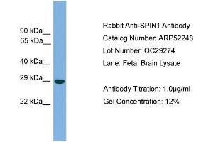 WB Suggested Anti-SPIN1  Antibody Titration: 0. (Spindlin 1 antibody  (Middle Region))