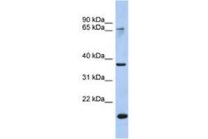 Image no. 1 for anti-Annexin A10 (ANXA10) (AA 179-228) antibody (ABIN6742711) (Annexin a10 antibody  (AA 179-228))