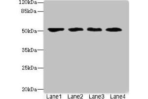 Western blot All lanes: LRRC42 antibody at 10 μg/mL Lane 1: MCF-7 whole cell lysate Lane 2: A549 whole cell lysate Lane 3: HCT116 whole cell lysate Lane 4: Colo320 whole cell lysate Secondary Goat polyclonal to rabbit IgG at 1/10000 dilution Predicted band size: 49 kDa Observed band size: 49 kDa (LRRC42 antibody  (AA 201-428))